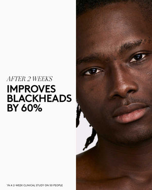 Infographics with text on the left and model on the right. Text reads: After 2 weeks improves blackheads by 60% in a 2-week clinical study on 50 people.
